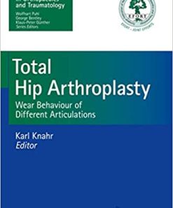Total Hip Arthroplasty Wear Behaviour of Different Articulations