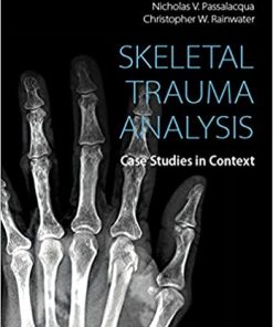 Skeletal Trauma Analysis Case Studies in Context