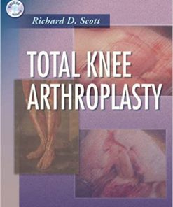 Total Knee Arthroplasty