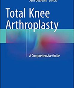 Total Knee Arthroplasty A Comprehensive Guide
