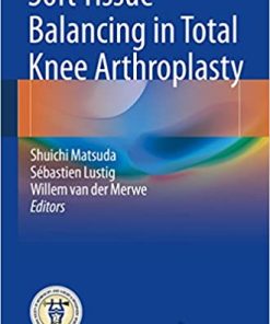 Soft Tissue Balancing in Total Knee Arthroplasty