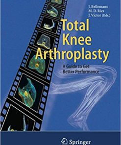 Total Knee Arthroplasty A Guide to Get Better Performance