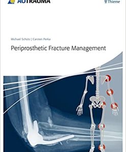 Periprosthetic Fracture Management