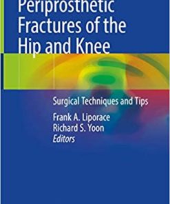 Periprosthetic Fractures of the Hip and Knee Surgical Techniques and Tips